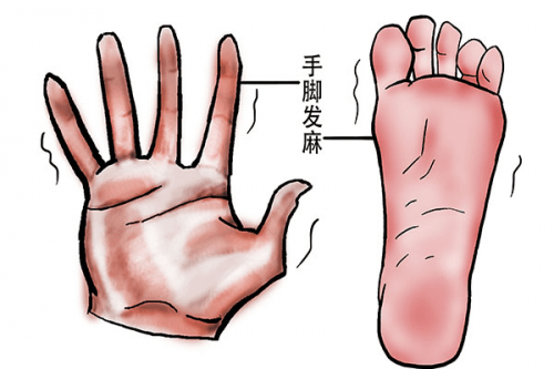 手腳經(jīng)常發(fā)麻是什么原因?手腳發(fā)麻可能患有哪些疾病？